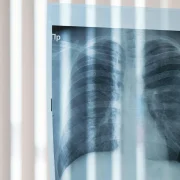 RöntgenbilderundKnochengesundheit