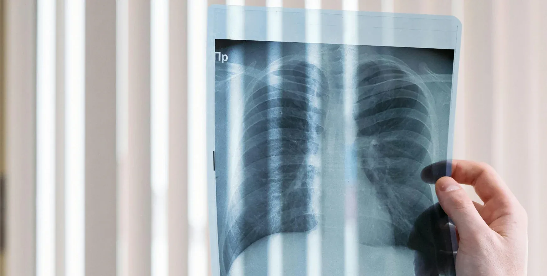 Knochengesundheit und Kakao 2 RöntgenbilderundKnochengesundheit